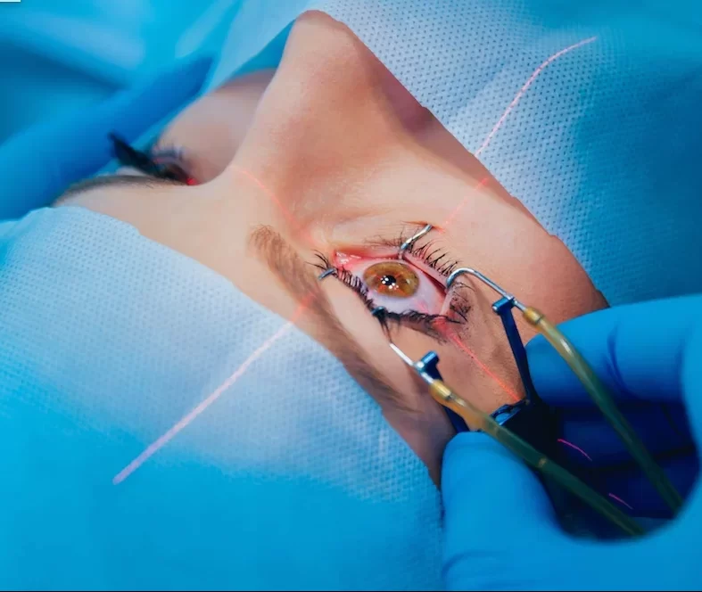 Cataract Surgery Turkey