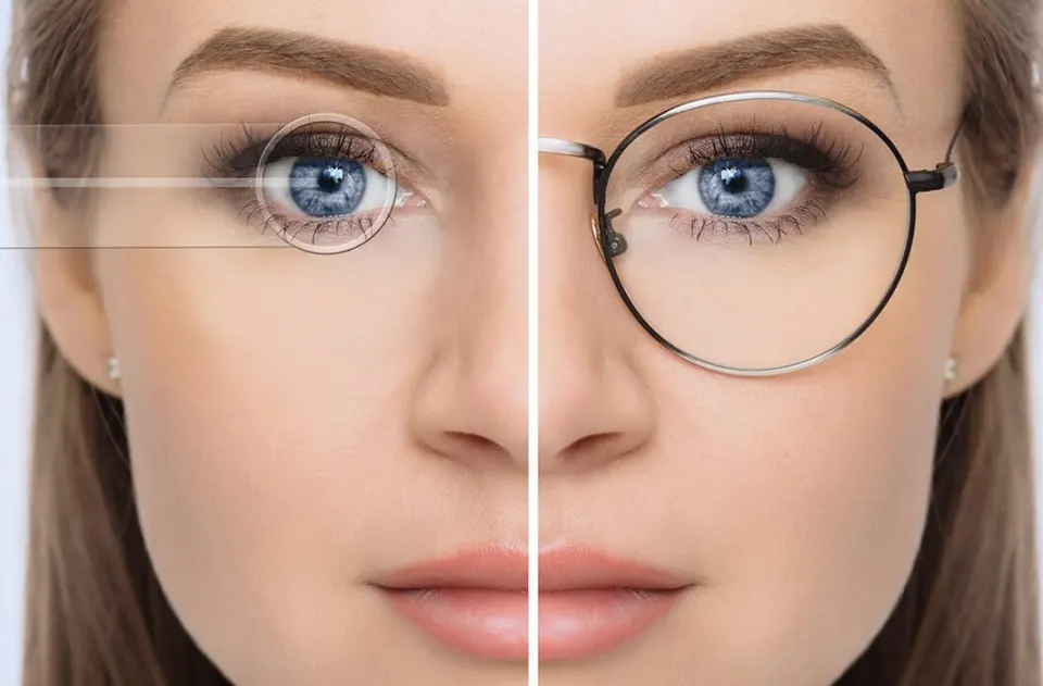 Lasik Eye Laser Surgery Turkey, Woman Patient before and after glasses