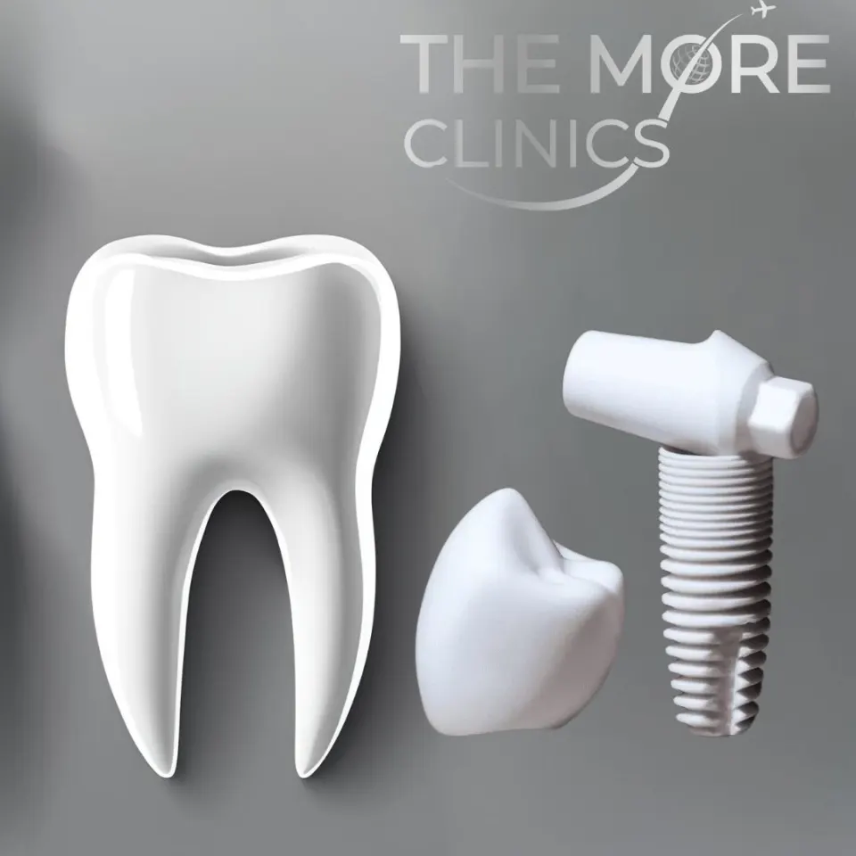 Keramikimplantate & Zirkonimplantat 2026: Kosten, metallfrei & vs Titan (Türkei Option)