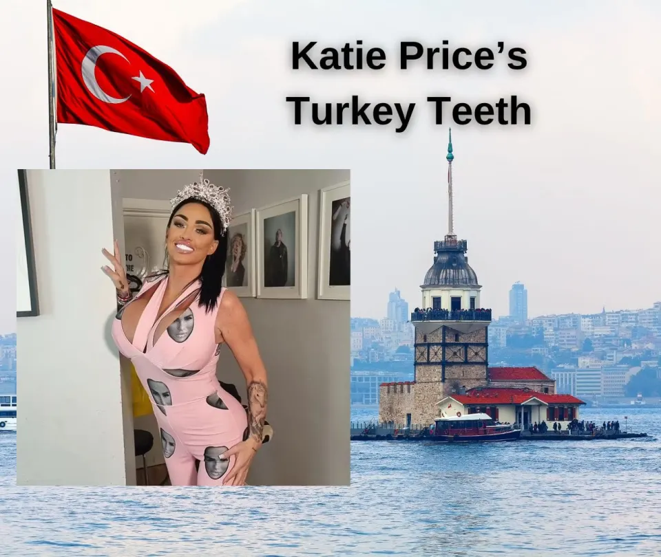 katie price turkey teeth