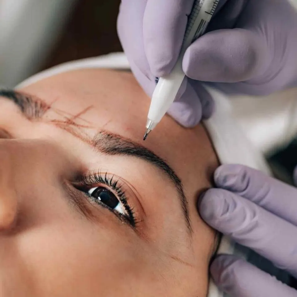 eyebrow transplant turkey price and experiences