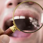 missing tooth Turkey