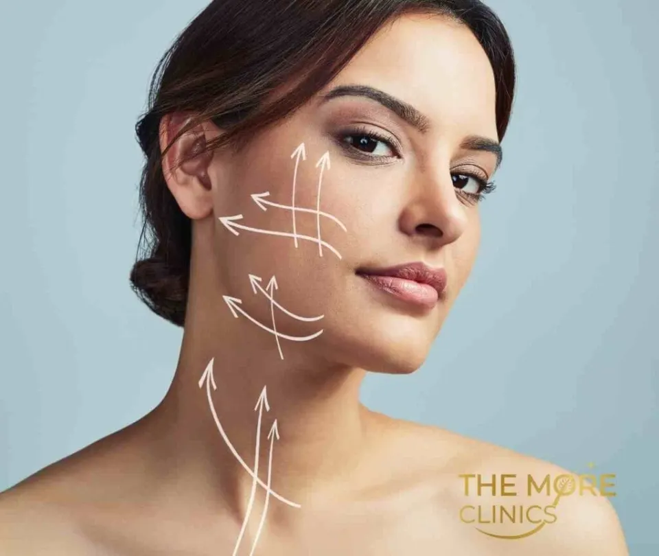 deep plane facelift turkey