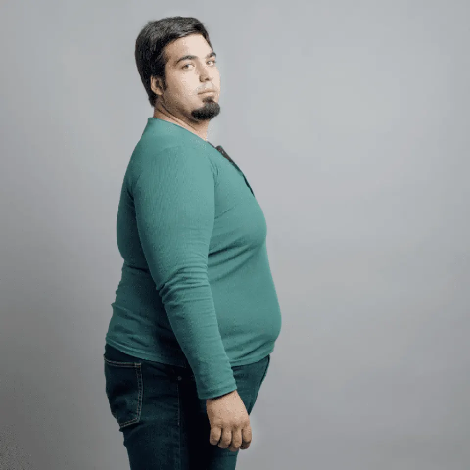 Gastric bypass surgery Turkey