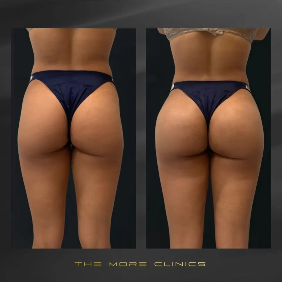 Aesthetic before & after 13