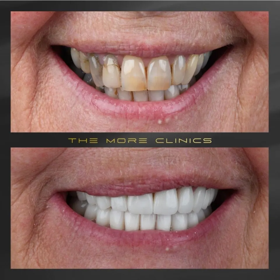 Dental before & after 27