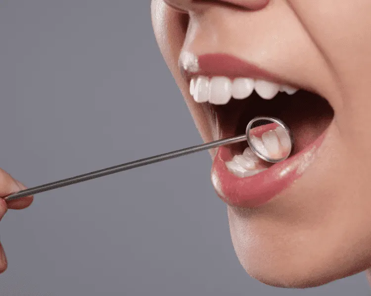 Periodontal disease treatment — scaling root planing gum surgery