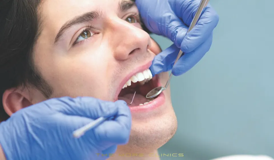 Smile Makeover Turkey