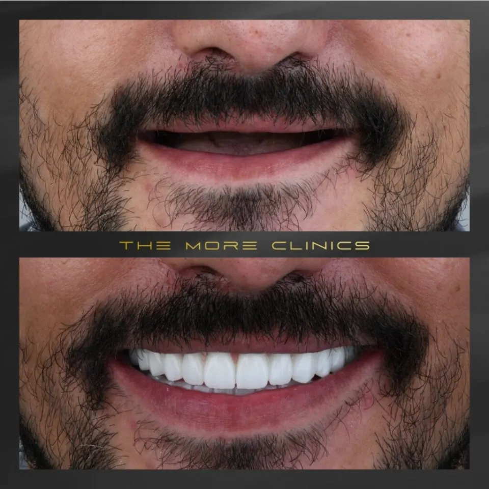 Dental before & after 9