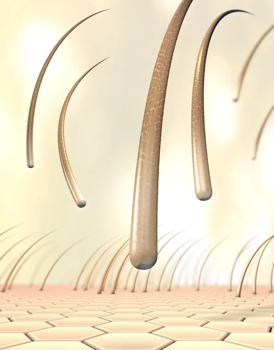 telogen effluvium temporary hair loss