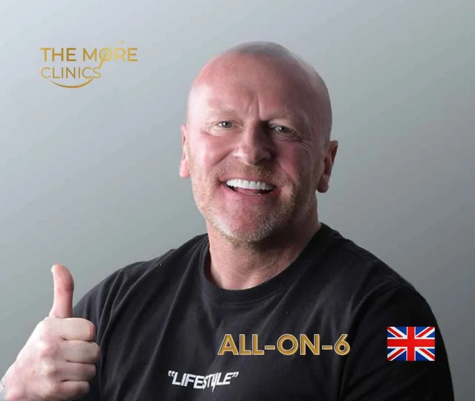 all on 4 implant dentures cost 