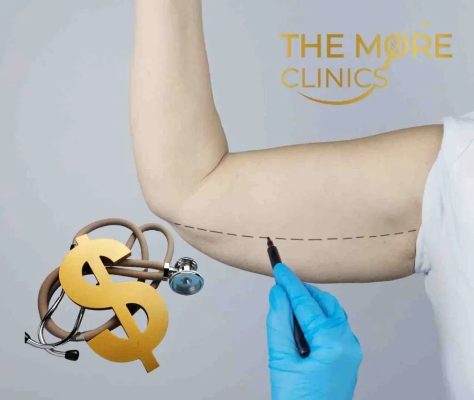brachioplasty cost of arm  lift