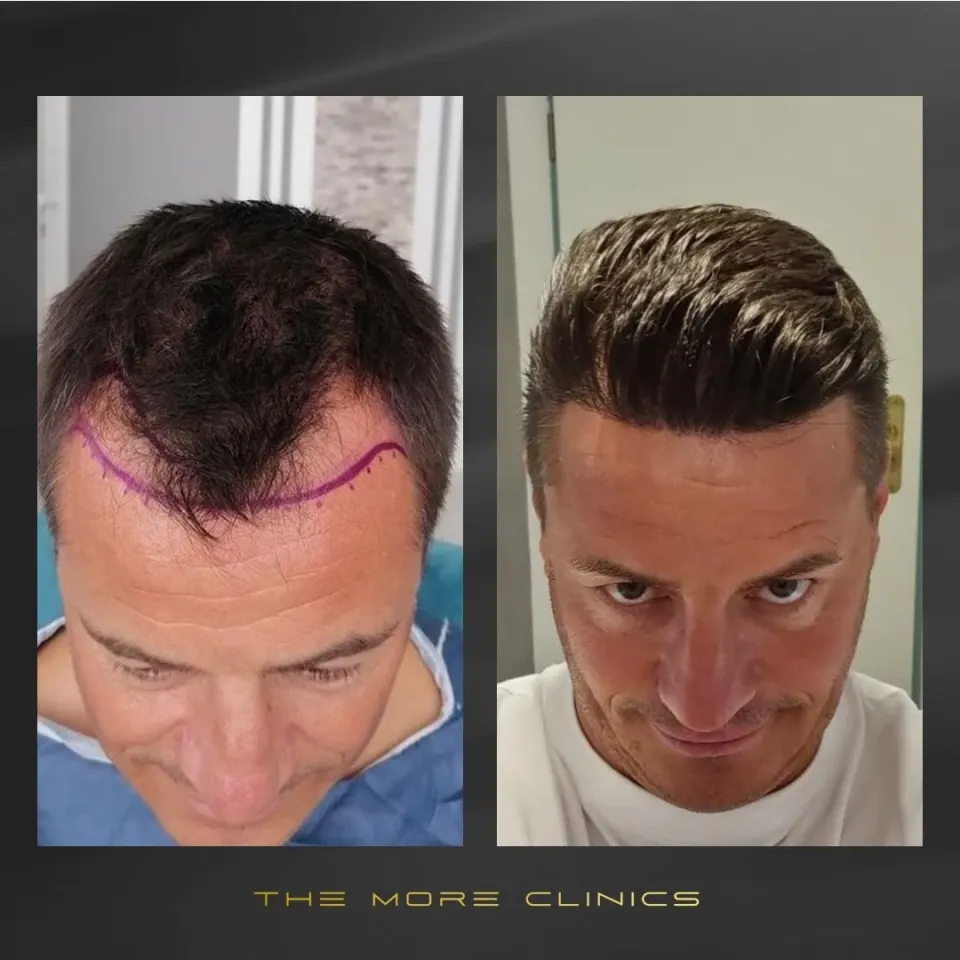Hair before & after 10