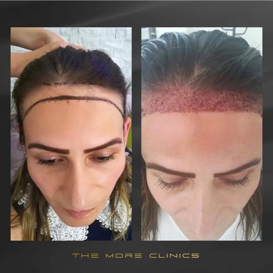 Hair before & after 34