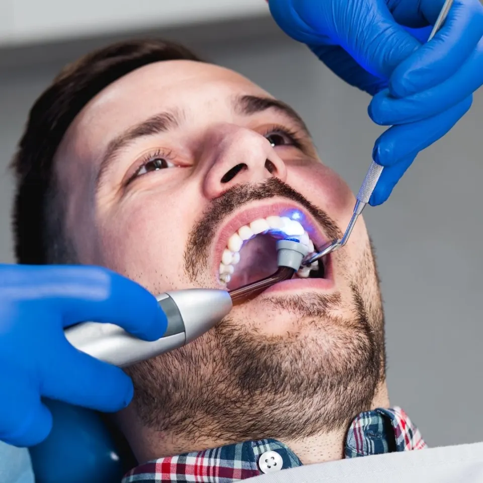 Dental veneers treatment result The More Clinics