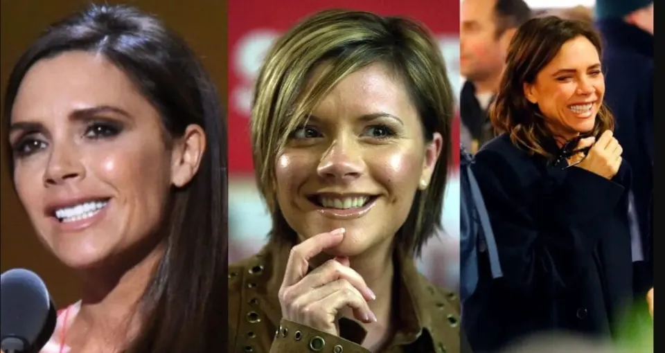 Victoria Beckham Teeth Before and After.