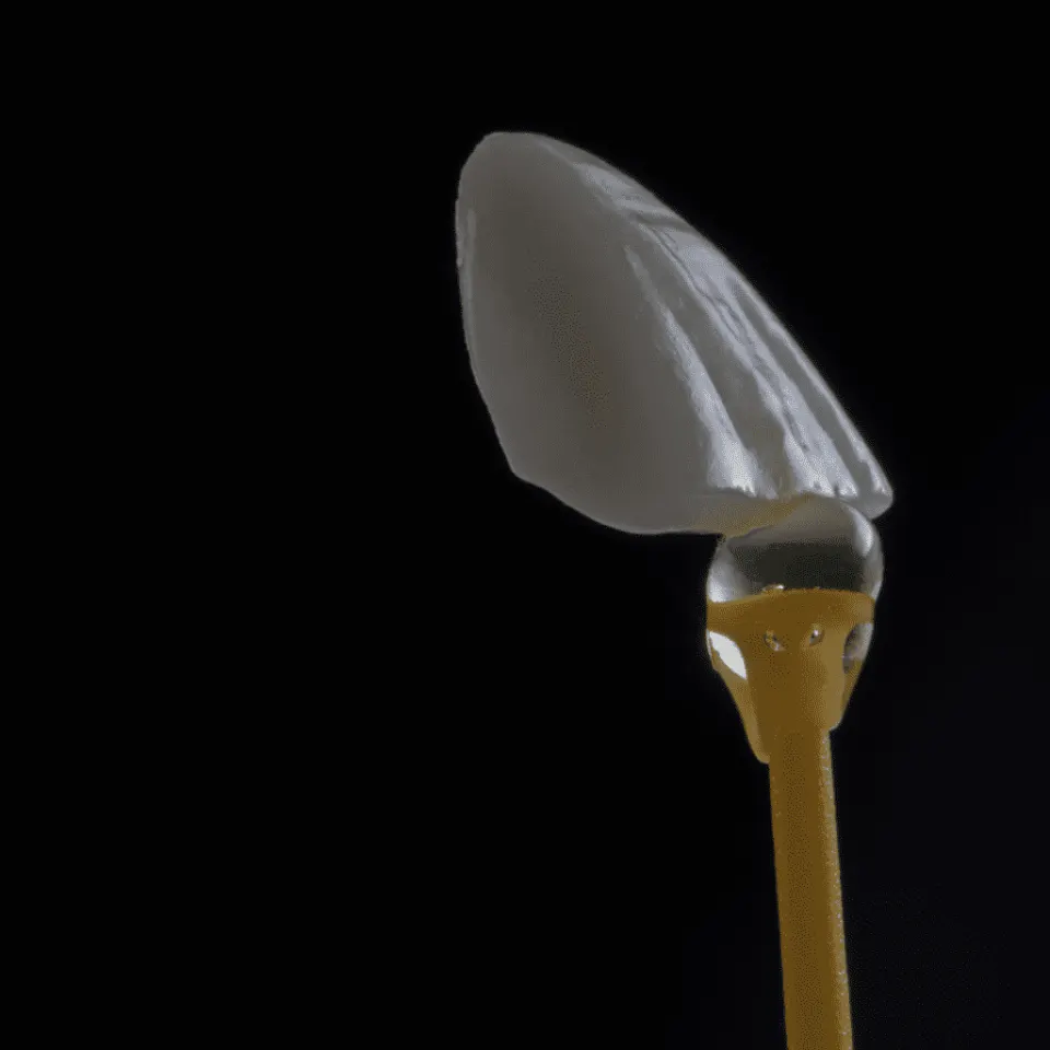 Antalya Dental Veneers