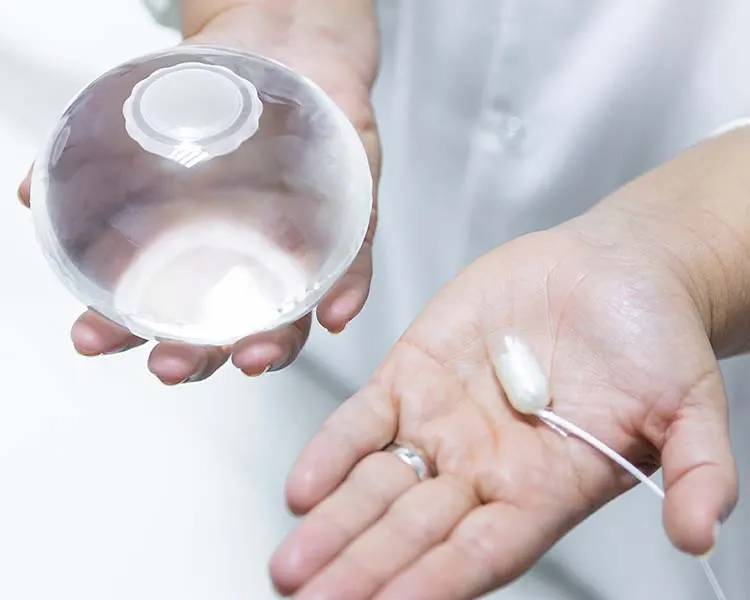 SWALLOWABLE GASTRIC BALLOON (ALLURION)