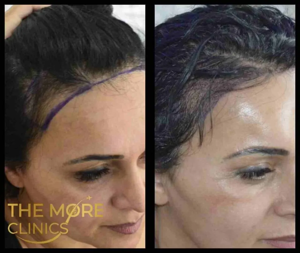 Haare vorher & nachher 37