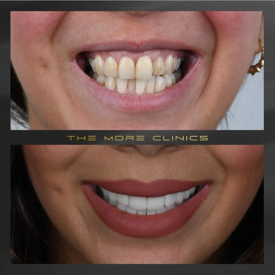 Dental before & after 41
