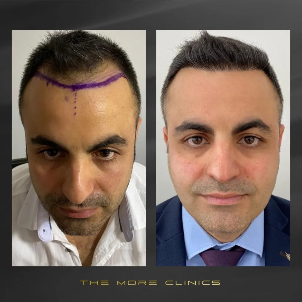 Hair before & after 9