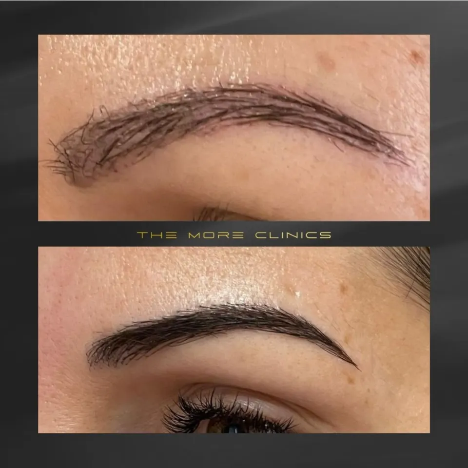Hair before & after 36