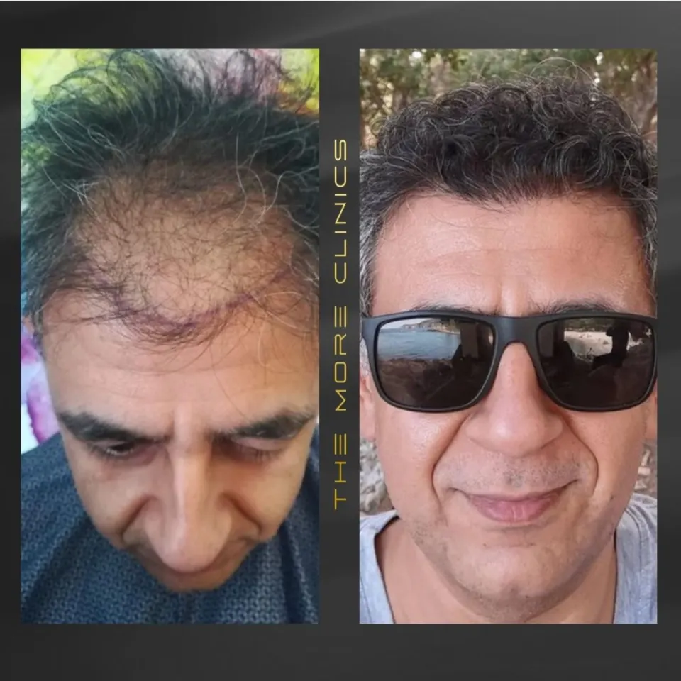 Hair before & after 23