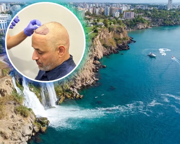 Haartransplantation in Antalya: Kosten, Erfahrungen & Ablauf