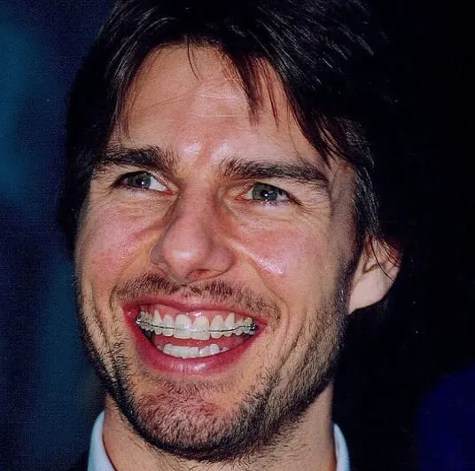 Tom Cruise Teeth Before