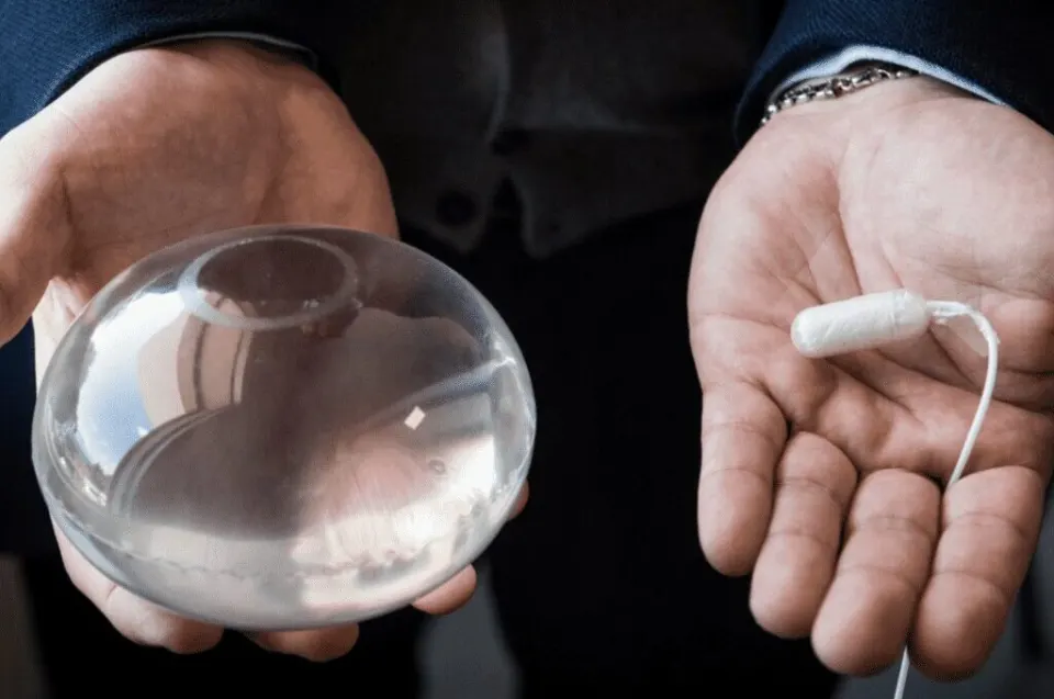 Swallowable gastric balloon (Allurion / Elipse) — no endoscopy, capsule-based, cost guide 2026