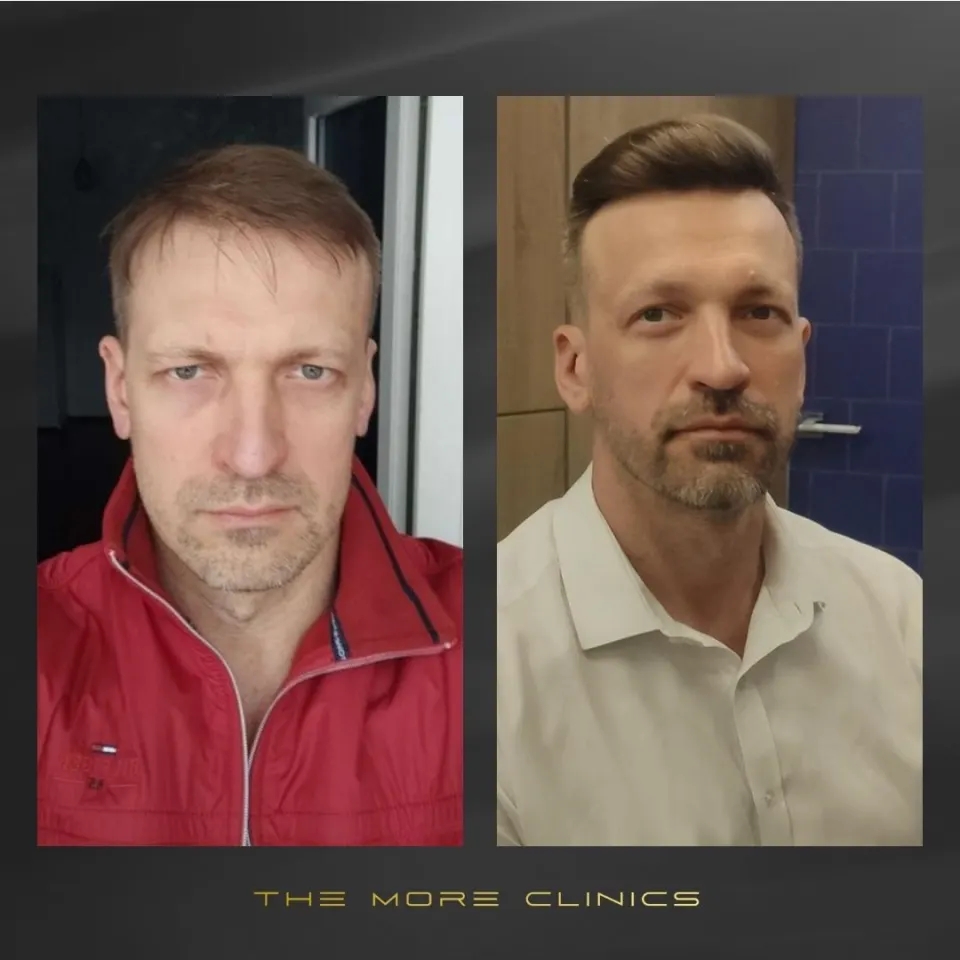 Hair before & after 13