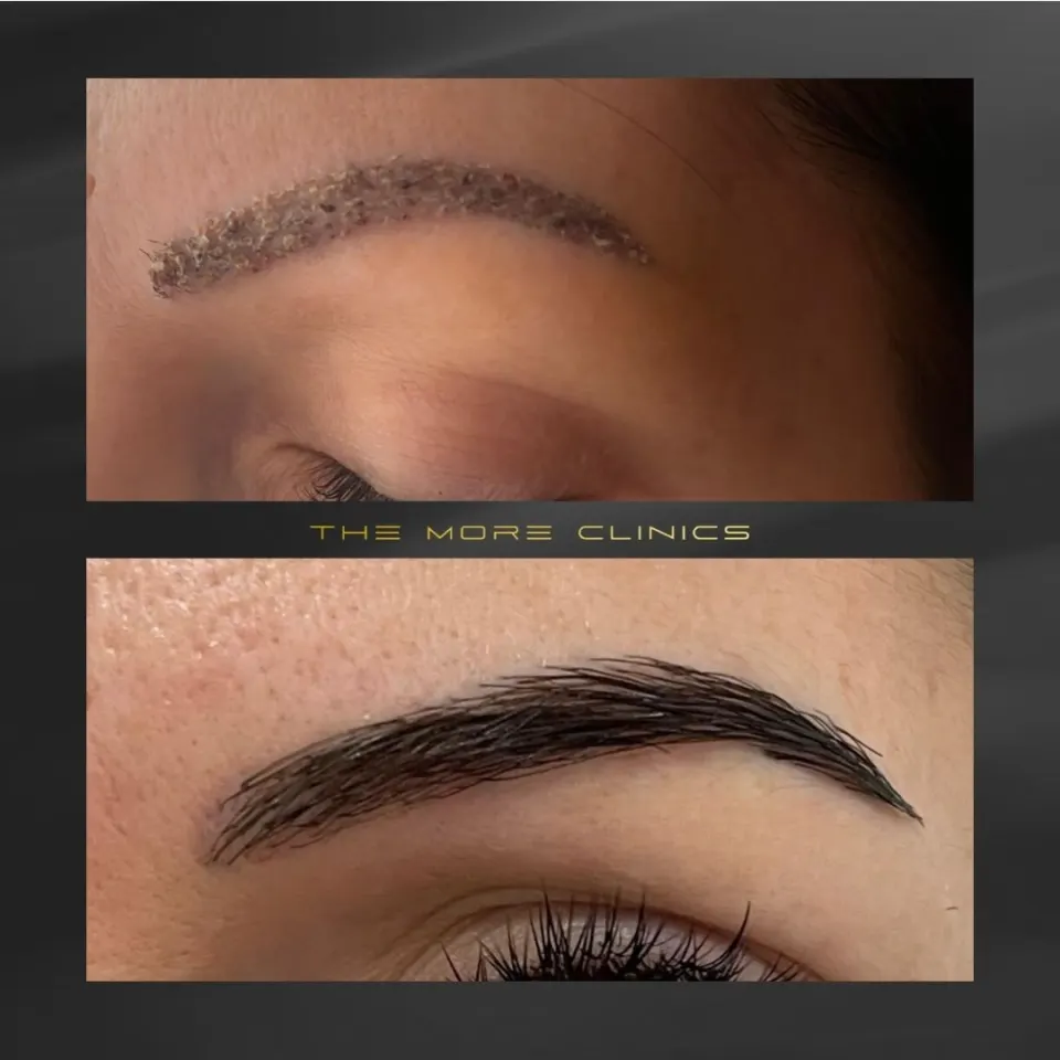 Hair before & after 38