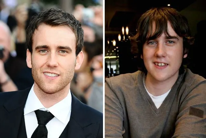 Matthew Lewis Teeth Before and After