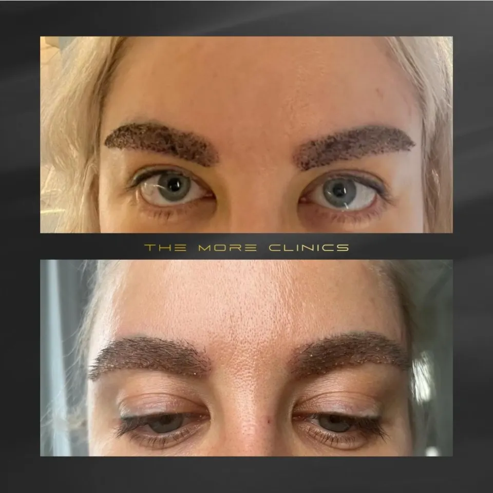 Hair before & after 40