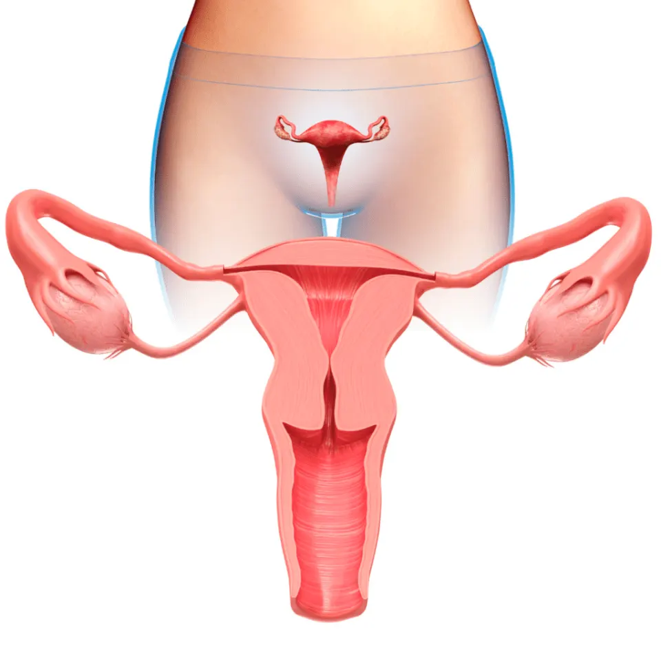 vaginoplasty before and after