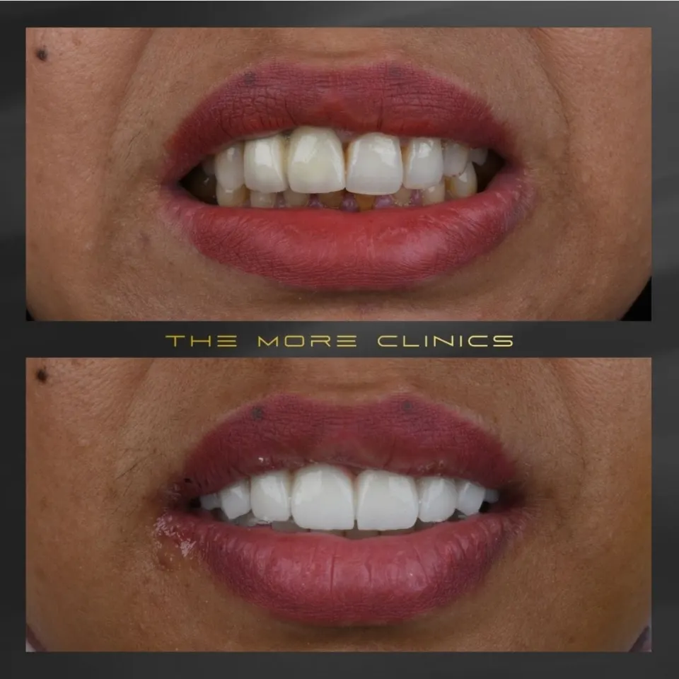 Dental before & after 36