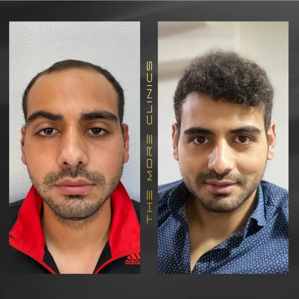 Hair before & after 7