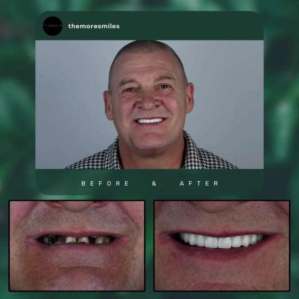 Dental before & after 10