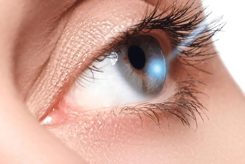 Why ReLEx SMILE Eye Laser Surgery vs lasik