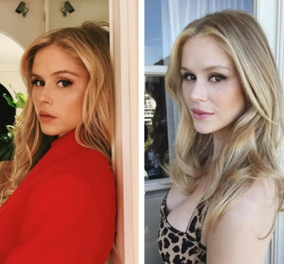 erin-moriarty-before-and-after-cosmetic-surgery