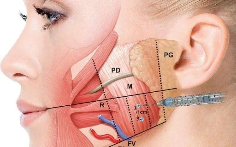 tmj treatment botox