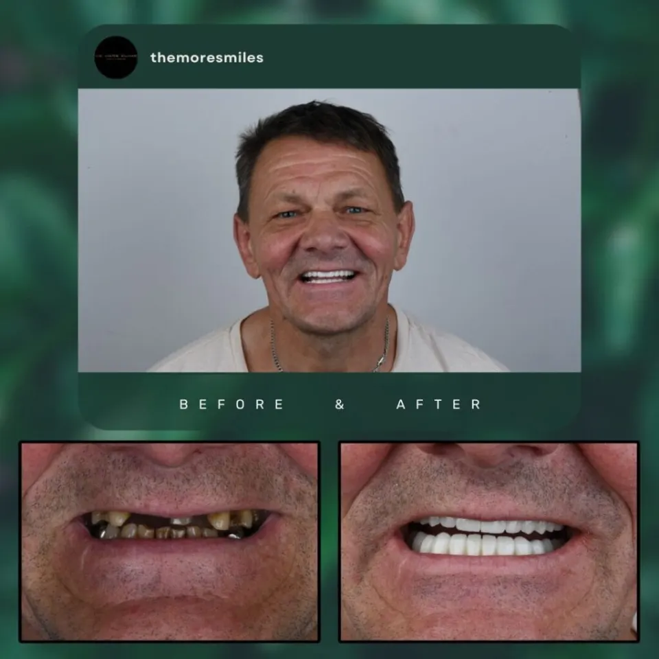 Dental results 1