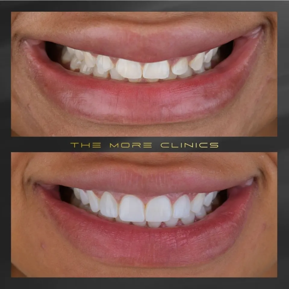 Dental before & after 21