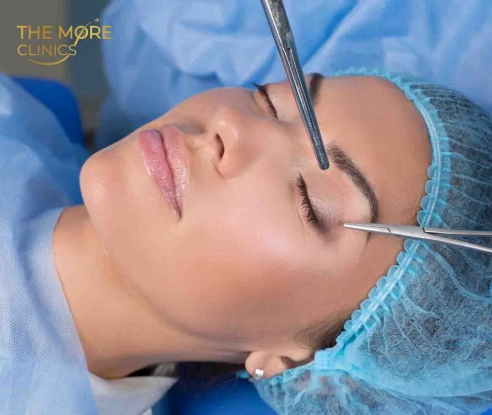 corrective eyelid surgery antalya turkey