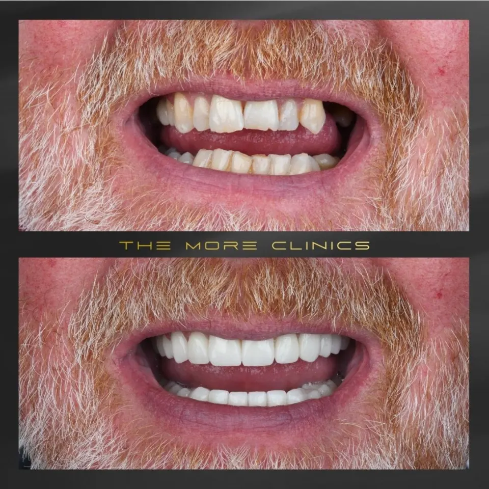 Dental before & after 24