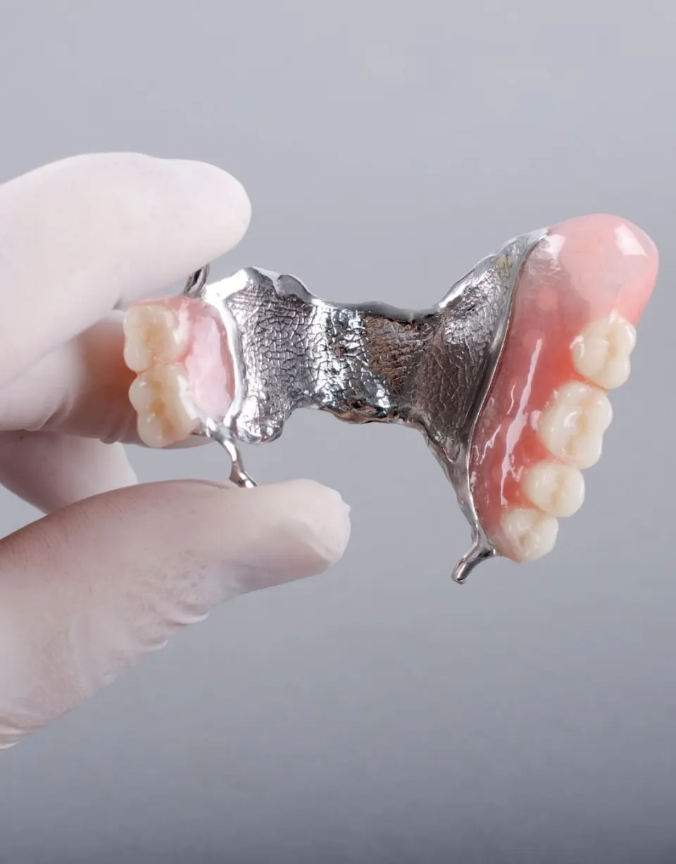 Partial and flexible dentures — types and UK cost comparison 2026