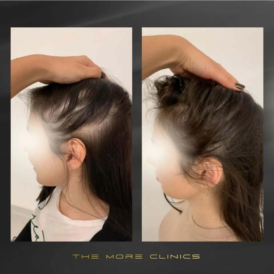Hair before & after 32